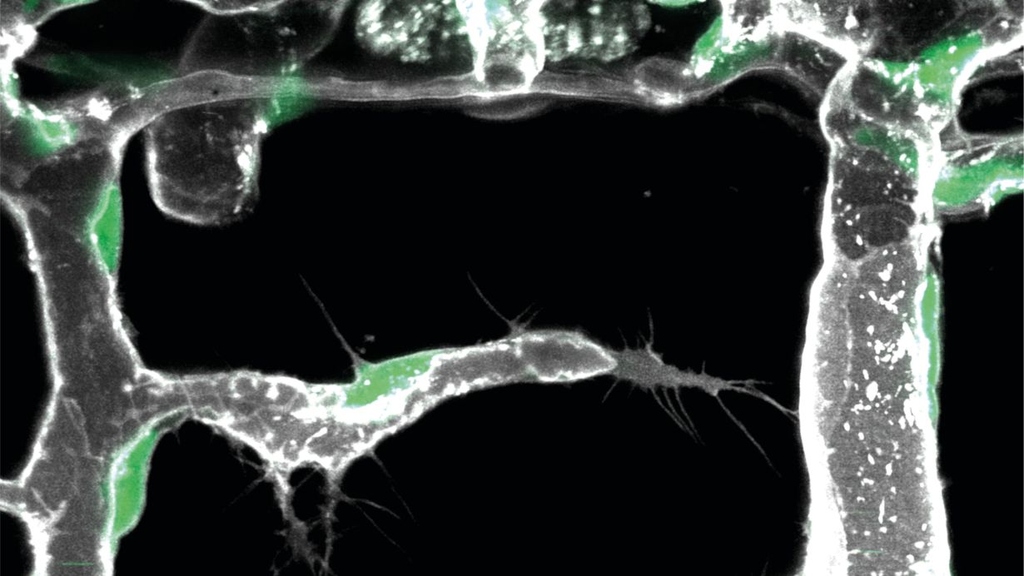 Image of active pioneer cell (center of image). Green indicates endothelial cell nucleus, grey the outline of the blood vessels. (Photo: Zoological Institute, KIT)